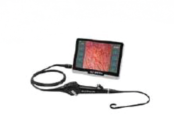 Flexible Video Cysto-Nephroscope